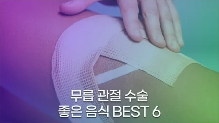 무릅 관절 수술 후 좋은 음식 BEST 6